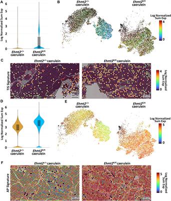 Ehmt2 inactivation in pancreatic epithelial cells shapes the transcriptional landscape and inflammation response of the whole pancreas